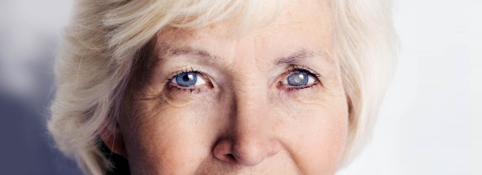 Cataract Surgery in North Central Omaha